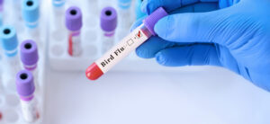Bird Flu test